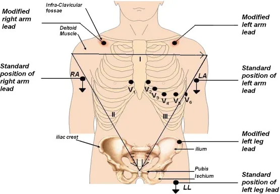 Ecg